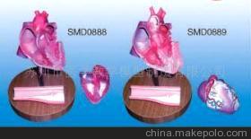 SMD0888心冠状动脉搭桥模型 医学教学模型的专业选择